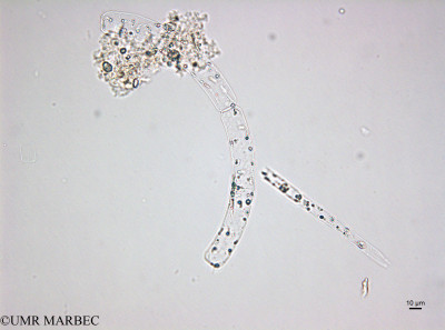 phyto/Brazilian_Amazon_coast/Amazomix_station_22/AMAZOMIX September 2021/Guinardia striata (St22_120922_guinardia_striata220912_001_ovl-3).tif(copy)_thumb.jpg